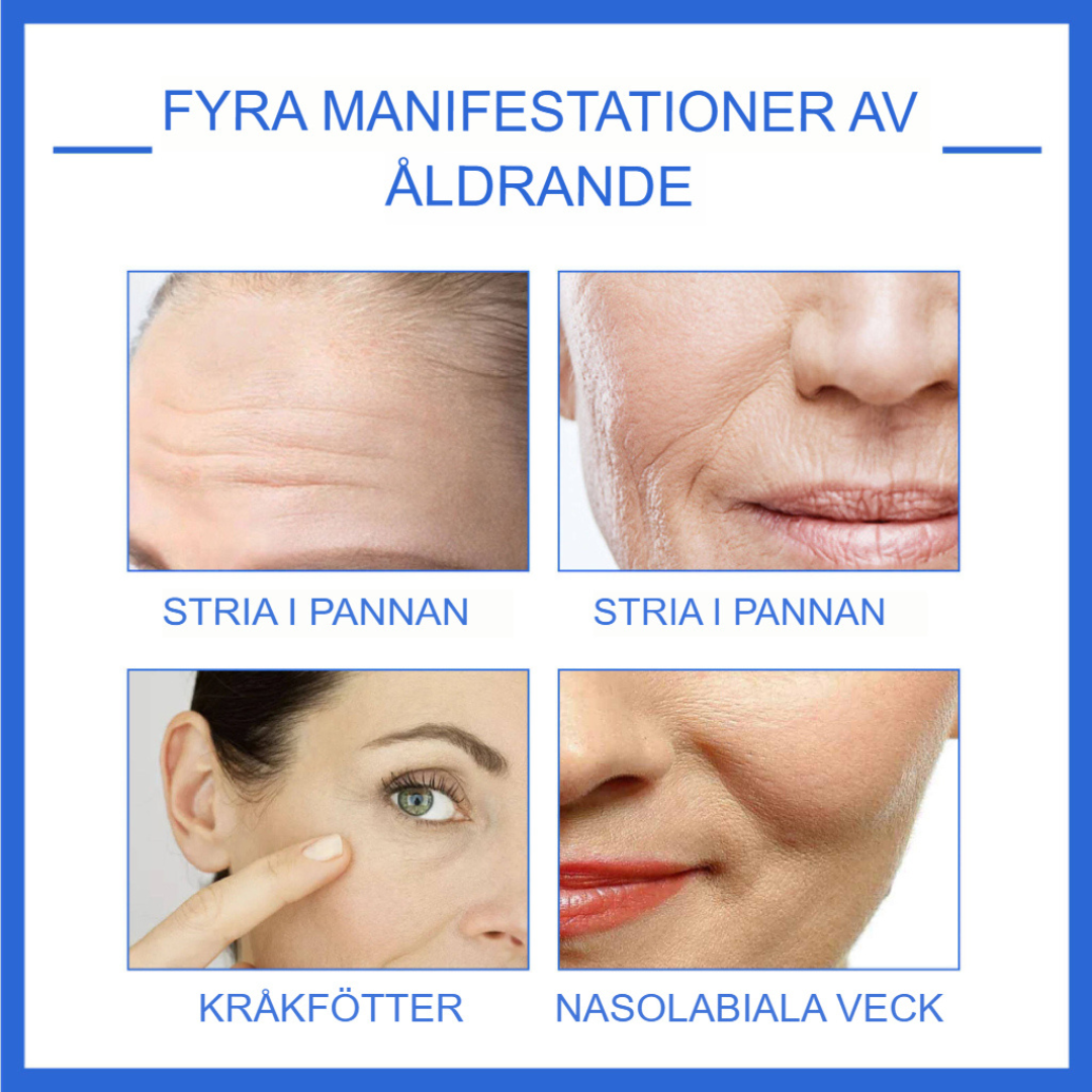 AgeDefy | Botox Stock-lösning för Avancerad Rynkreduktion