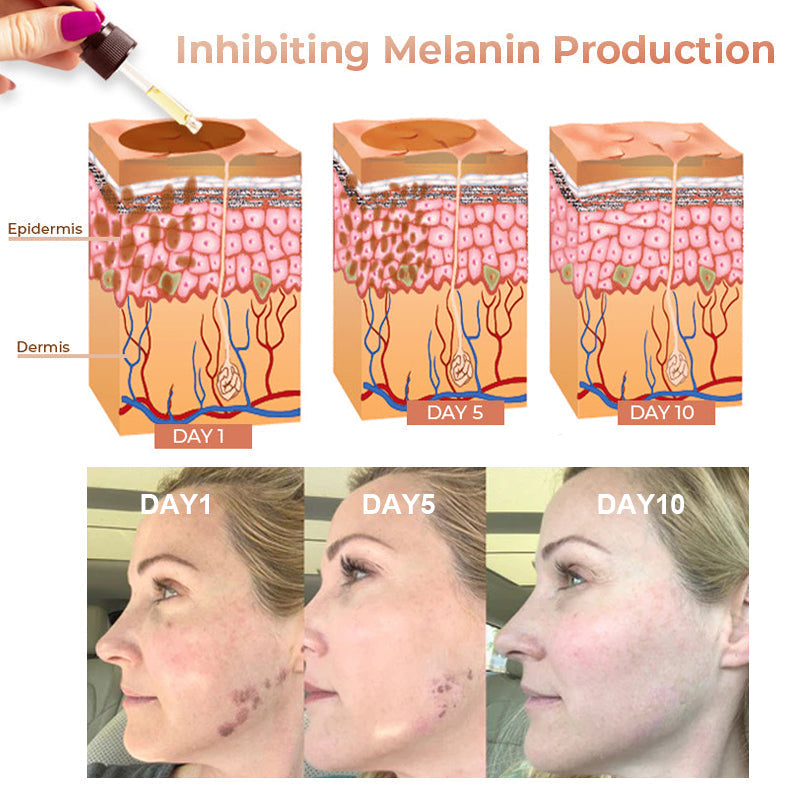 ✨ LUMISKIN™ Snabb Borttagning av Mörka Fläckar - Melanin Korrigerande Ansiktsserum