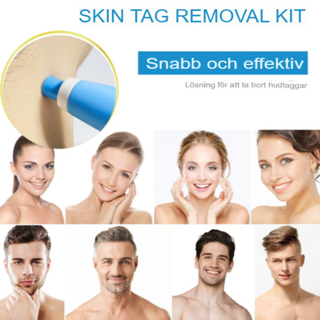 QuickFix Hudflik Borttagningskit | Snabb, Smärtfri Lösning för Klar Hud