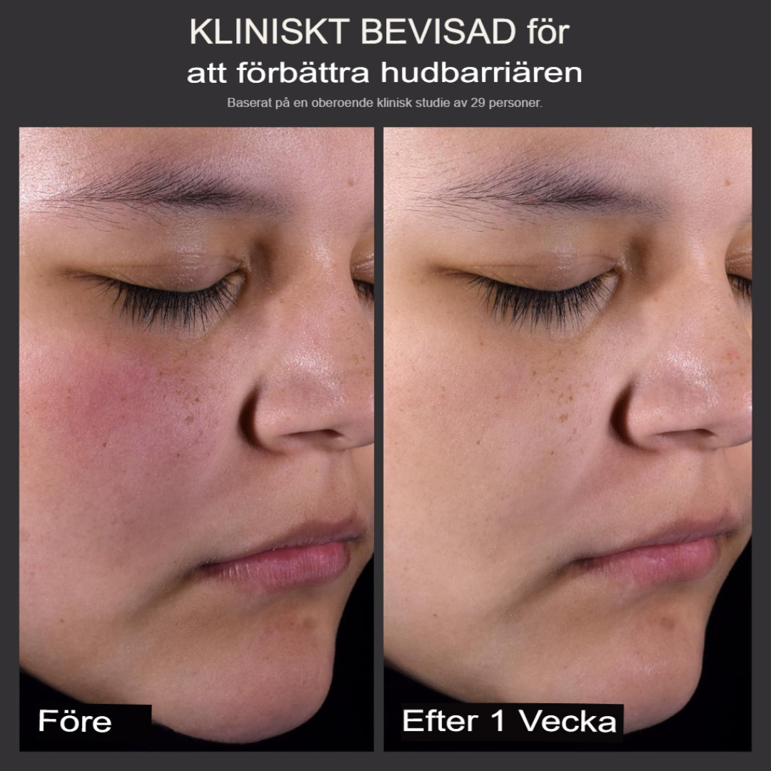 Paula's Choice 2% BHA Exfoliant | Förfinande Salicylsyralösning för Porer, Rynkor & Pormaskar