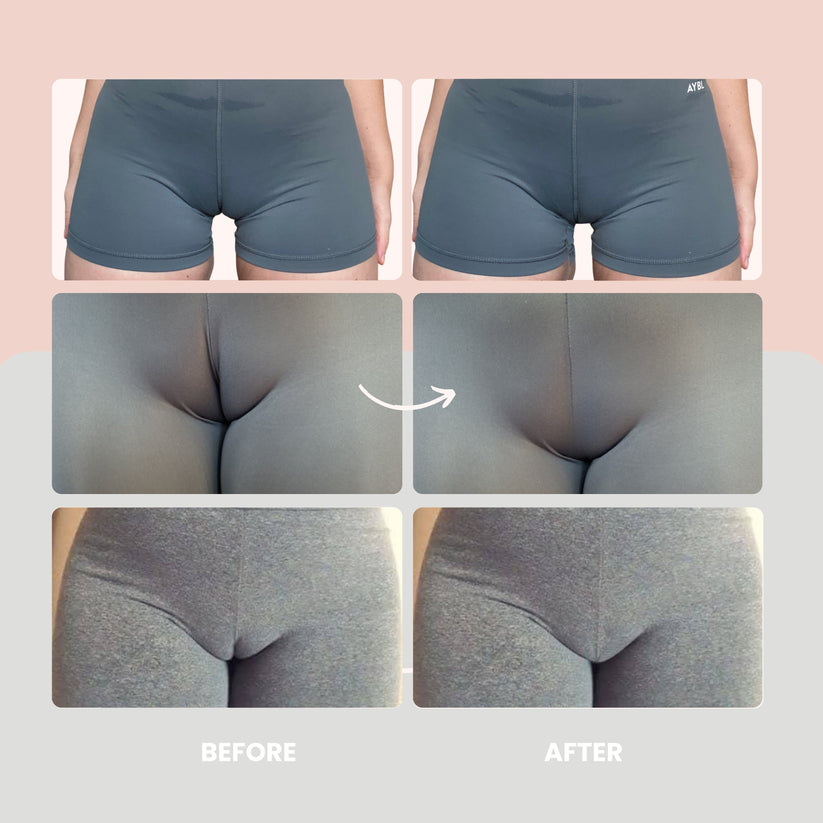 Elsa™ Invisible Camel Toe String 1+1 GRATIS
