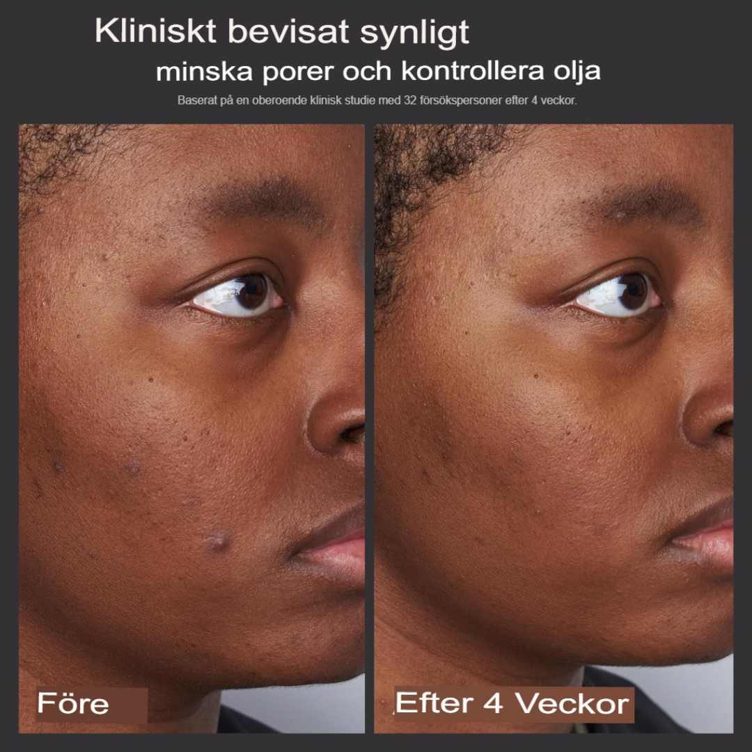 Paula's Choice 2% BHA Exfoliant | Förfinande Salicylsyralösning för Porer, Rynkor & Pormaskar