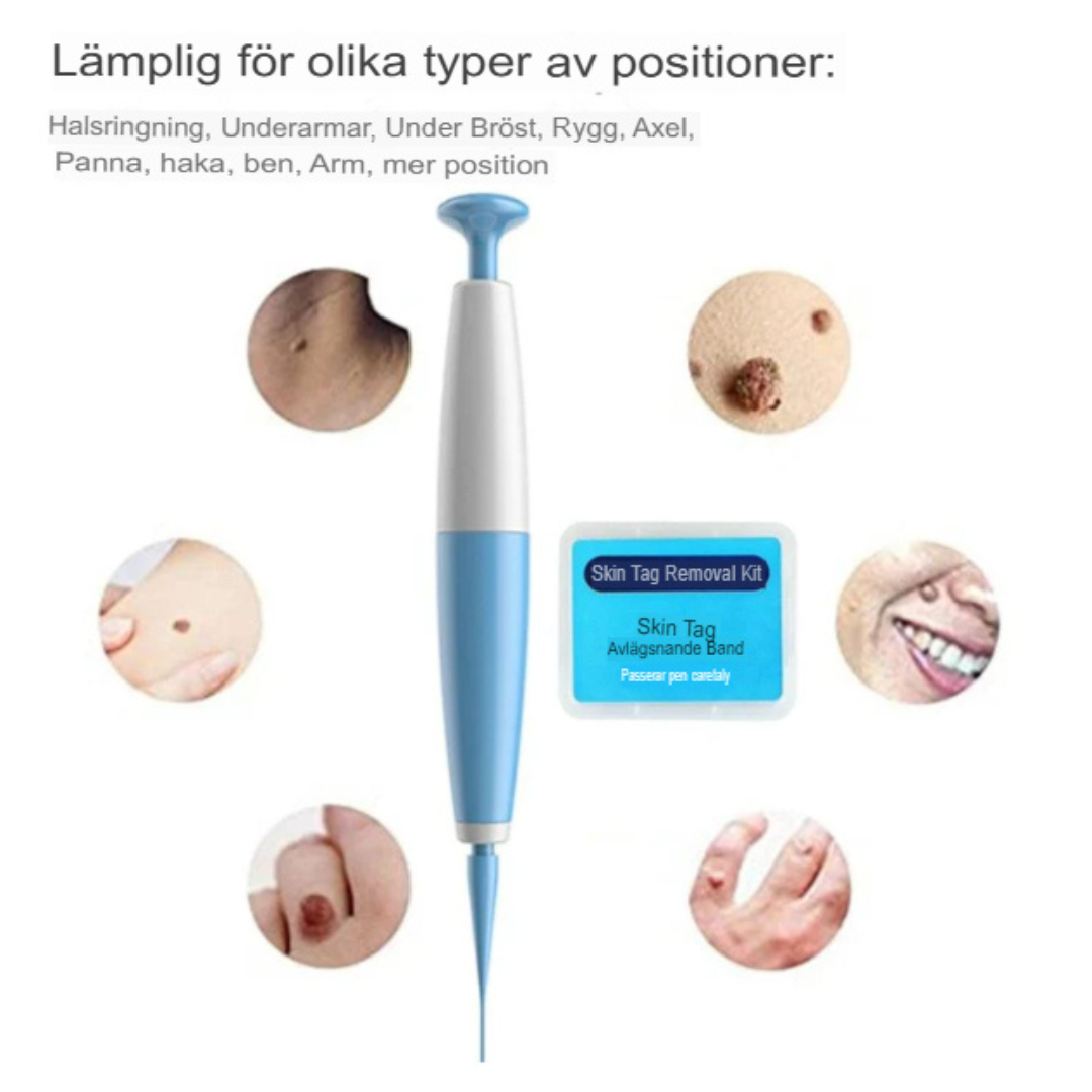 QuickFix Hudflik Borttagningskit | Snabb, Smärtfri Lösning för Klar Hud