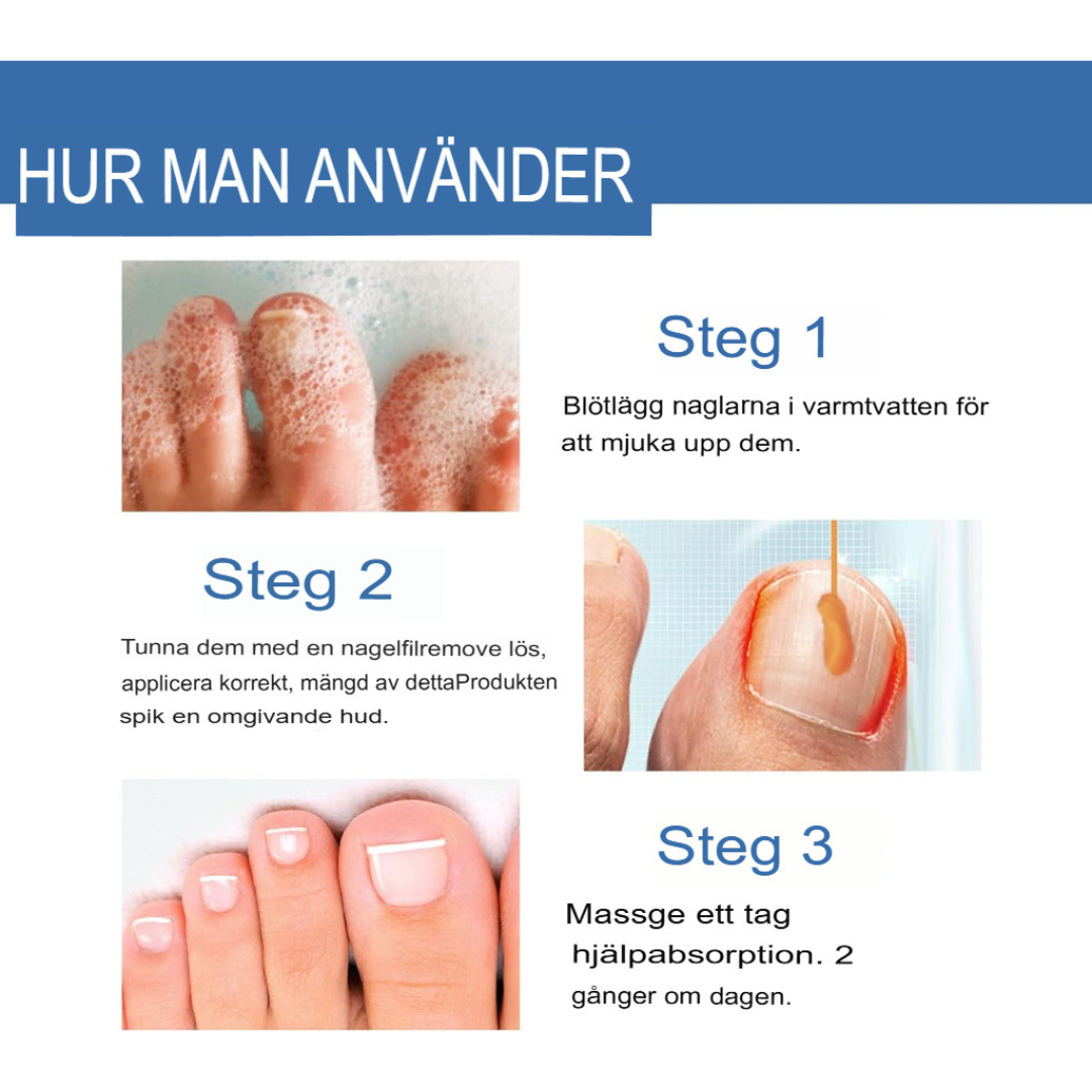 Snabb svampsalva | Effektiv Antifungusbehandling