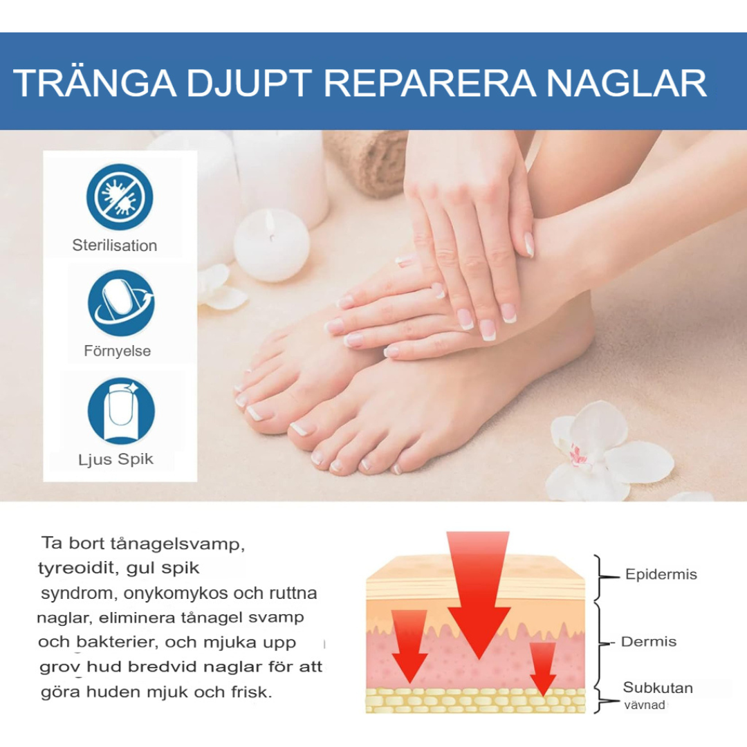 TotalCare Nagelsvampbehandling för Tånaglar | Effektiv Nagelåterställning & Vård