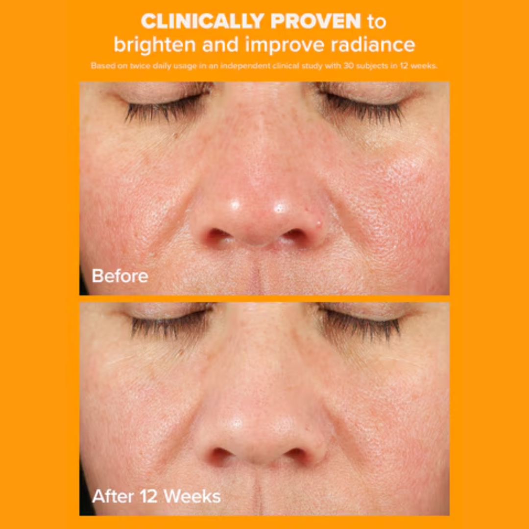 Paula's Choice C15 Super Booster | Anti-Aging Serum med 15% Vitamin C