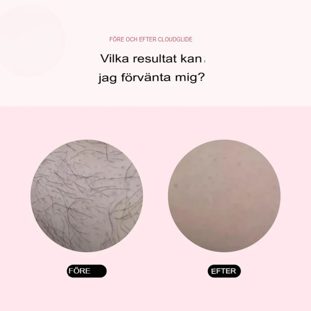 SmoothShave Dual | Precisions Rakapparat för Kvinnor