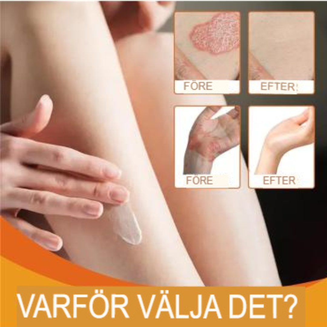 Wiyun | Kliniskt testad – Omedelbar lösning – Beställ nu! 🐝✅