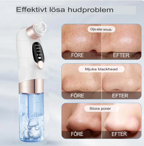 HydroPore Max | Ultimat Uppladdningsbar Pormask & Porrengörare