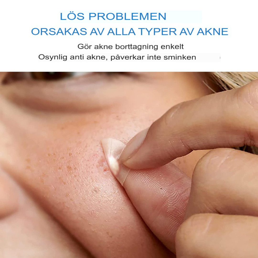 ClearSkin Akneöverdrag | Osynlig Hydrokolloid Behandling för Fläckfri Hud