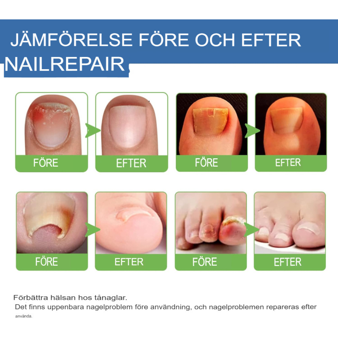 Snabb svampsalva | Effektiv Antifungusbehandling