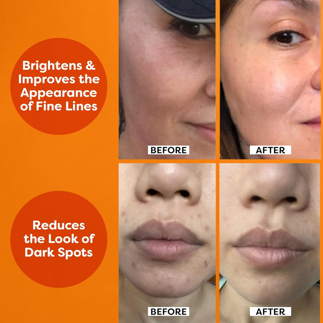 TruSkin Vitamin C Serum | Ljusande & Anti-Aging Formula med Hyaluronsyra & Vitamin E
