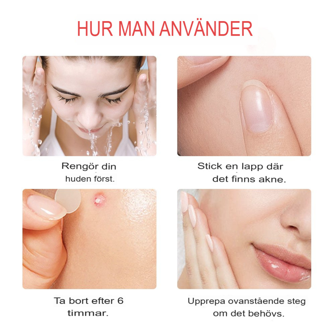 ClearSkin Akneöverdrag | Osynlig Hydrokolloid Behandling för Fläckfri Hud