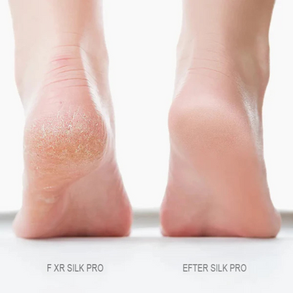 SmoothStep | Elektrisk Fotexfoliator