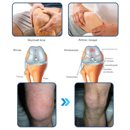 HydraJoint | Avancerad Hyaluronsyra Ledlindrande Kräm