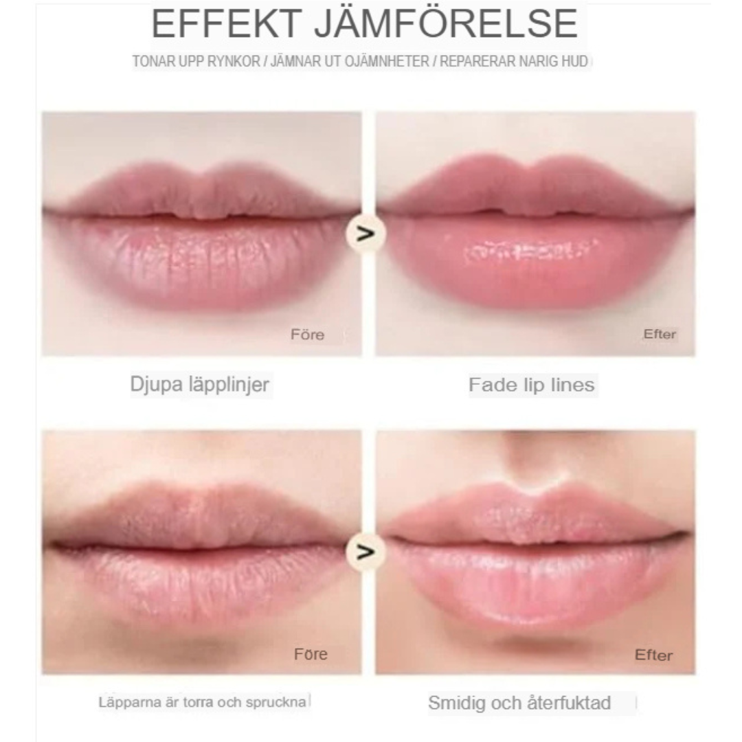 LipFix™ | Ultimativ hud-mikroinfusionsrulle
