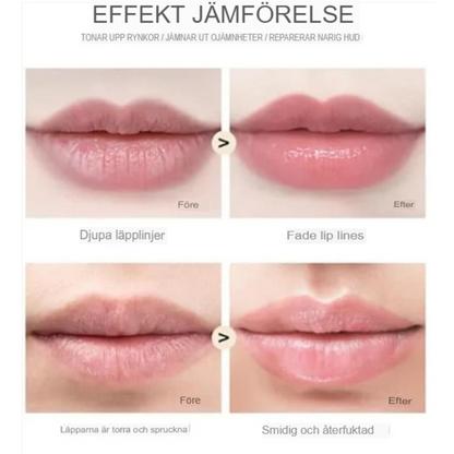 LipFix™ | Ultimativ hud-mikroinfusionsrulle