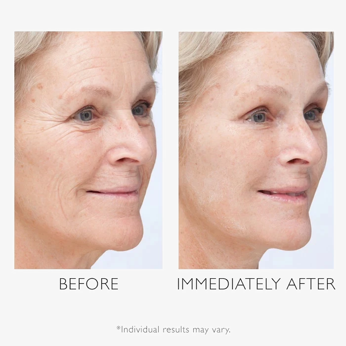 GlowRewind Anti-Wrinkle Cream