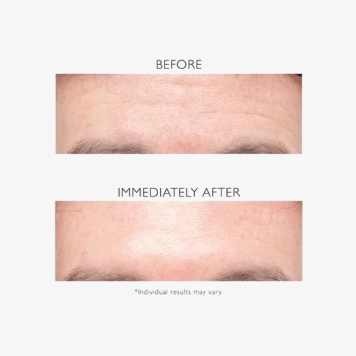 GlowRewind Anti-Wrinkle Cream