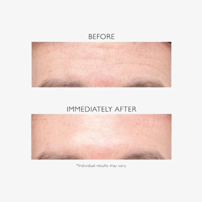 GlowRewind Anti-Wrinkle Cream